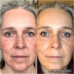 Nuskin ageLOC Boost + Pumps Bakuchiol 30 ml