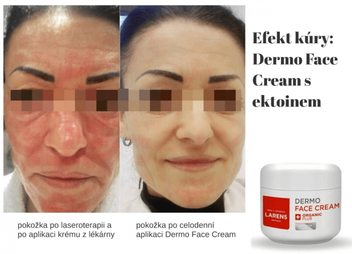 Dermo Face Cream 50ml