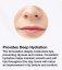 Kissme Lips® device + serum