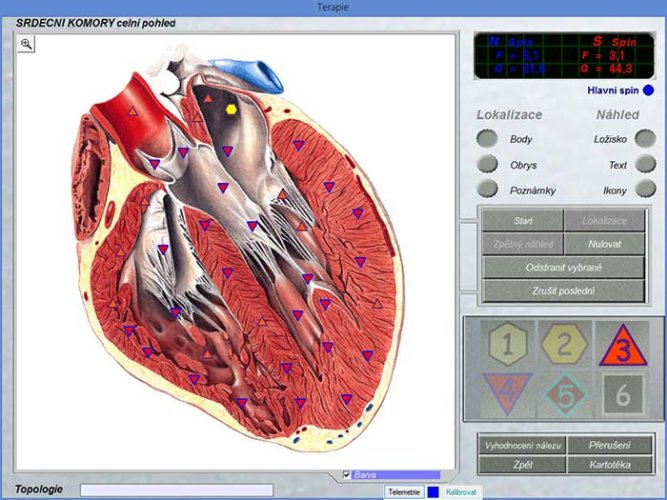 Oberon - diagnostika srdečních komor